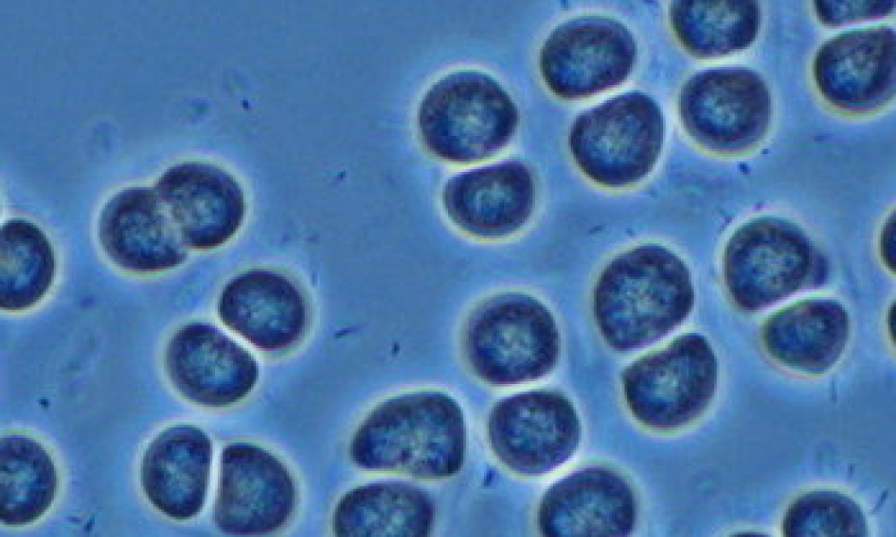 b307/0152 By yundaga